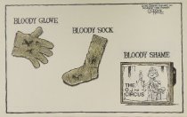 Bloody glove - Bloody sock - Bloody shame